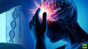 أخصائي روسي يكشف عن علامات اقتراب السكتة الدماغية